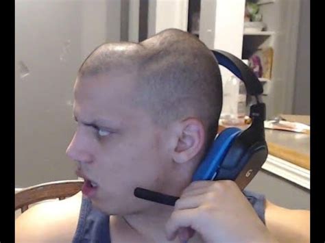 tyler1 head|why is tyler1s head dented.